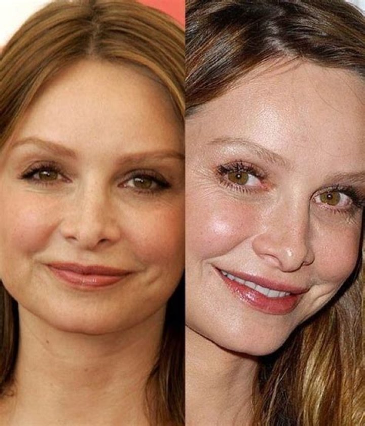 Calista Flockhart Plastic Surgery Before and After