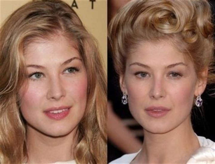 Rosamund Pike Plastic Surgery Before and After
