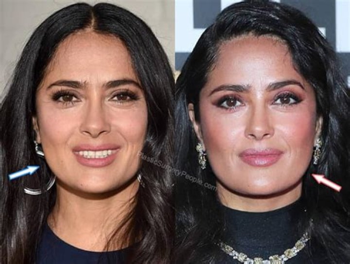 salma hayek plastic surgery