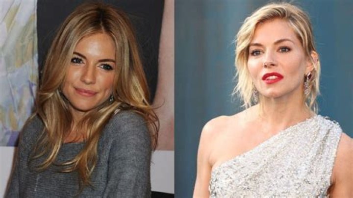 Sienna Miller Plastic Surgery Before and After