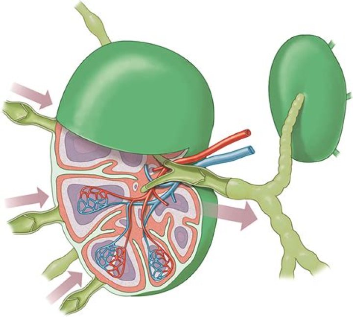 Vascularized Lymph Node Transfer to the Profunda Artery Perforator Pedicle: A Reliable Proximal Recipient Vessel Option in the Medial Thigh